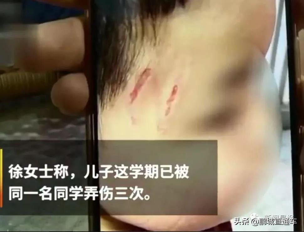 孩子在学校被欺负了应该怎么办？该打回去吗？专家教你这样做