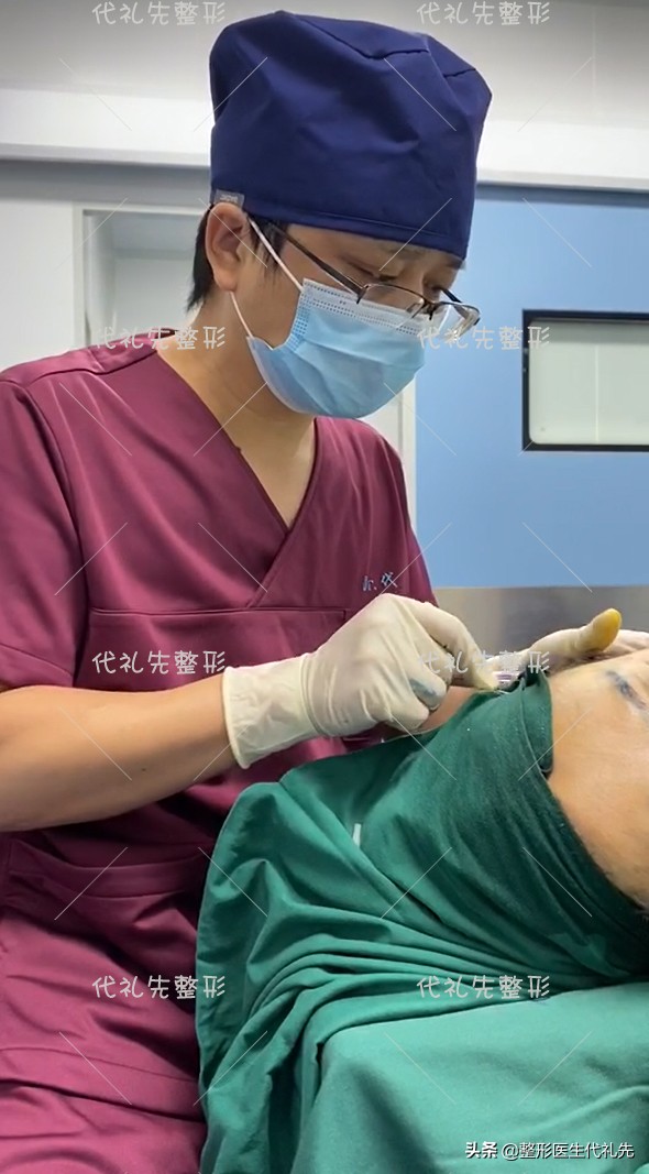 做线雕和不做线雕的好处,面部线雕能改善下颌线吗