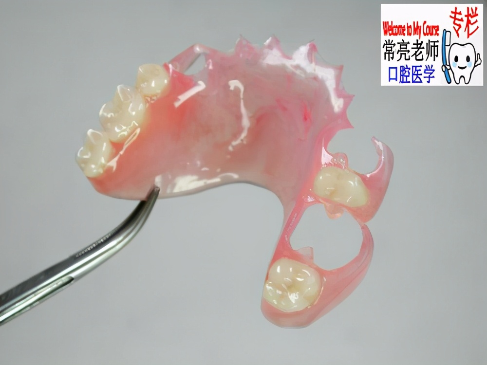 牙科医生讲义第七讲：可摘局部义齿初戴