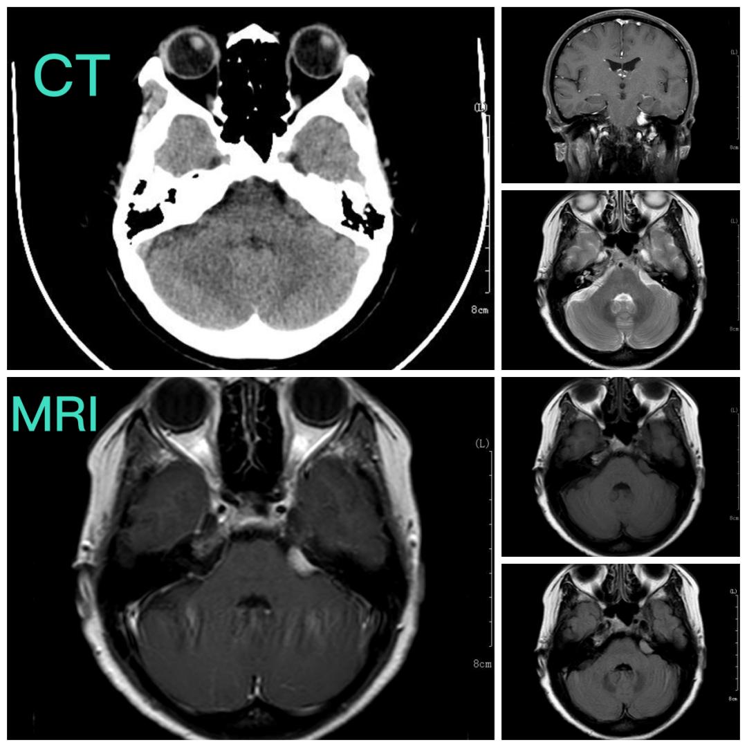 见微知著,内镜显神通