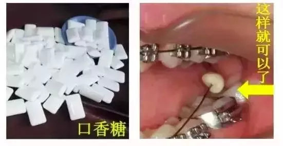 牙齿矫正出问题能要求赔偿吗,牙齿矫正越来越瘦什么问题
