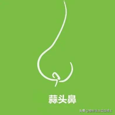 鼻整形如何一步到位,袁博整形医生