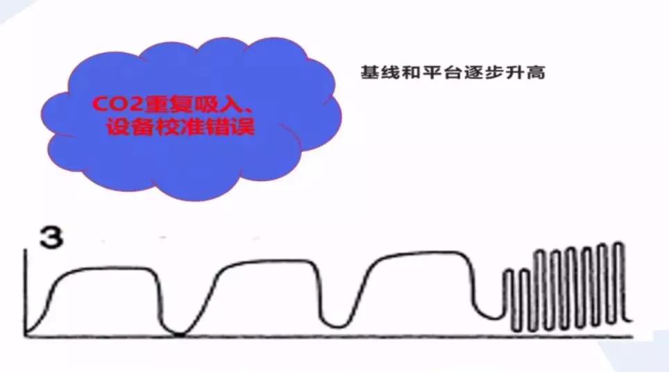 李娟教授：呼气末二氧化碳分压监测的临床应用