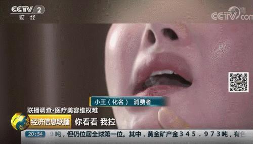 “毁了我一生！”25岁女孩整容成歪嘴，医院只赔5000元