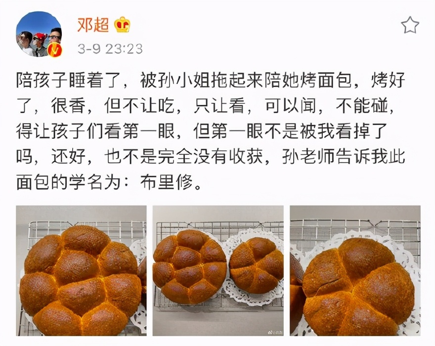 孙俪邓超扎针灸,邓超孙俪针灸