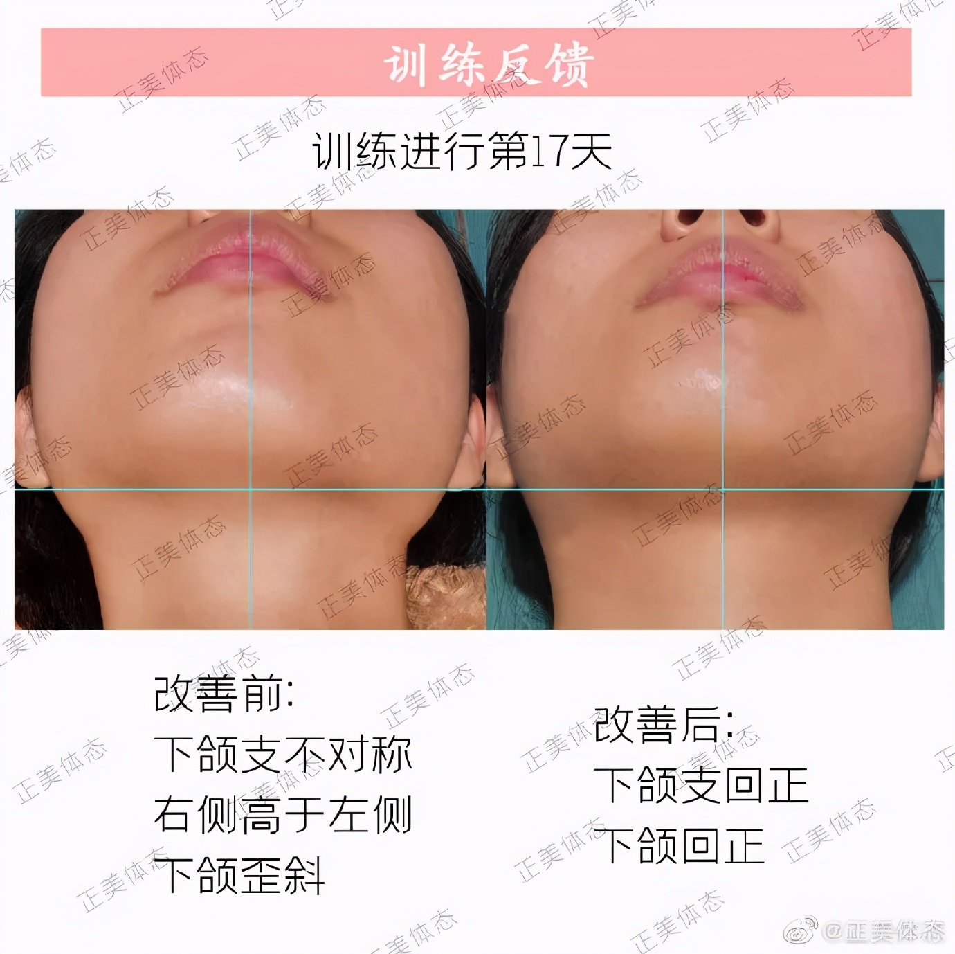 教你一招解决高低眉的小技巧,哪个动作可以改善高低眉