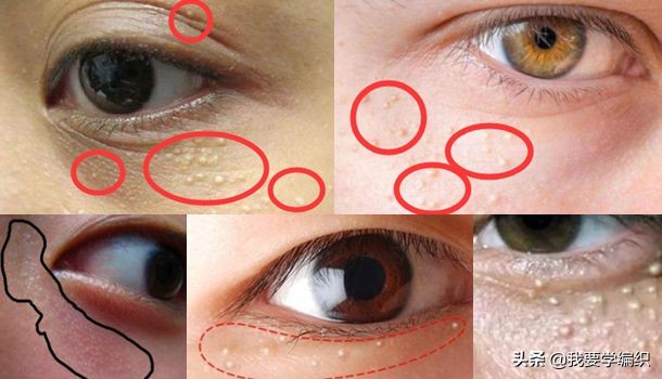 雅诗兰黛眼霜去细纹效果怎么样,雅诗兰黛祛眼纹吗