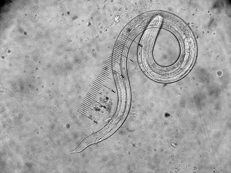 多地出现福寿螺寄生虫感染事例,2006年广东福寿螺寄生虫事件
