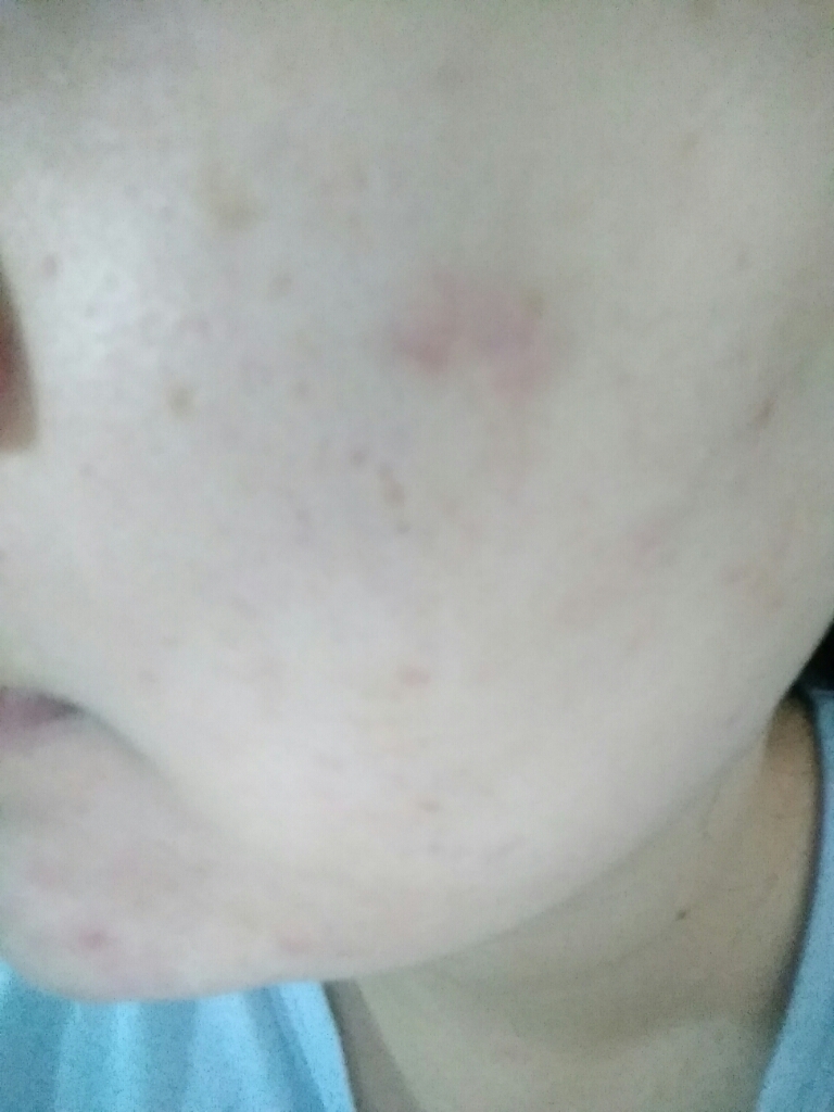 膜法世家绿豆泥浆面膜130g祛痘吗,膜法世家绿豆泥浆面膜效果评估