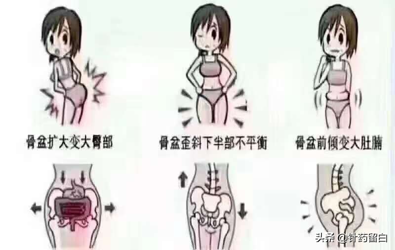 宝妈盆底肌松弛漏尿怎么办,产后七年盆底肌漏尿怎么解决