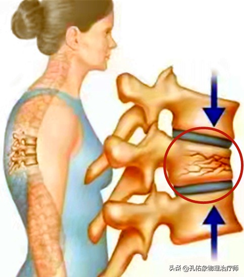 50岁更年期女性补钙的正确方法,50岁左右的女性出现各种疼痛