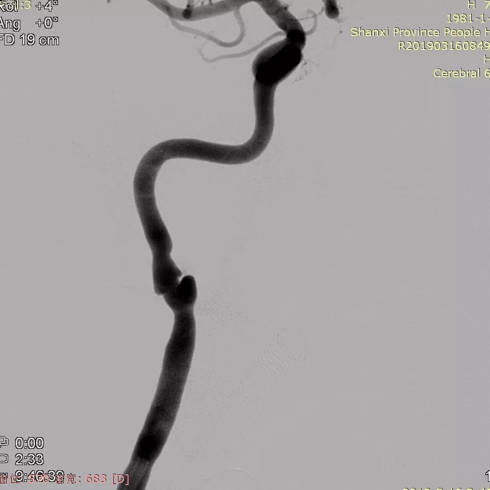 山西省人民医院任少华教授,山西省人民医院任少华