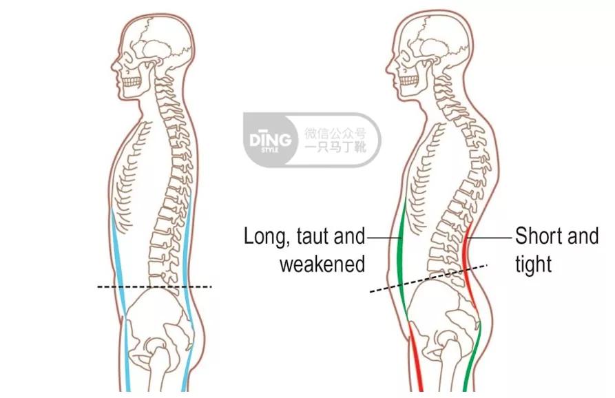 有效改善体态,提升气质减肥瘦全身方法