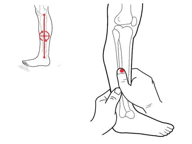 舌苔厚腻发白有红点是艾滋病吗,宝宝舌苔上有土怎么办