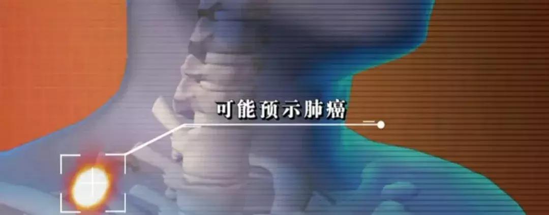 危险三角区会有什么症状,面部危险三角区有哪些危害