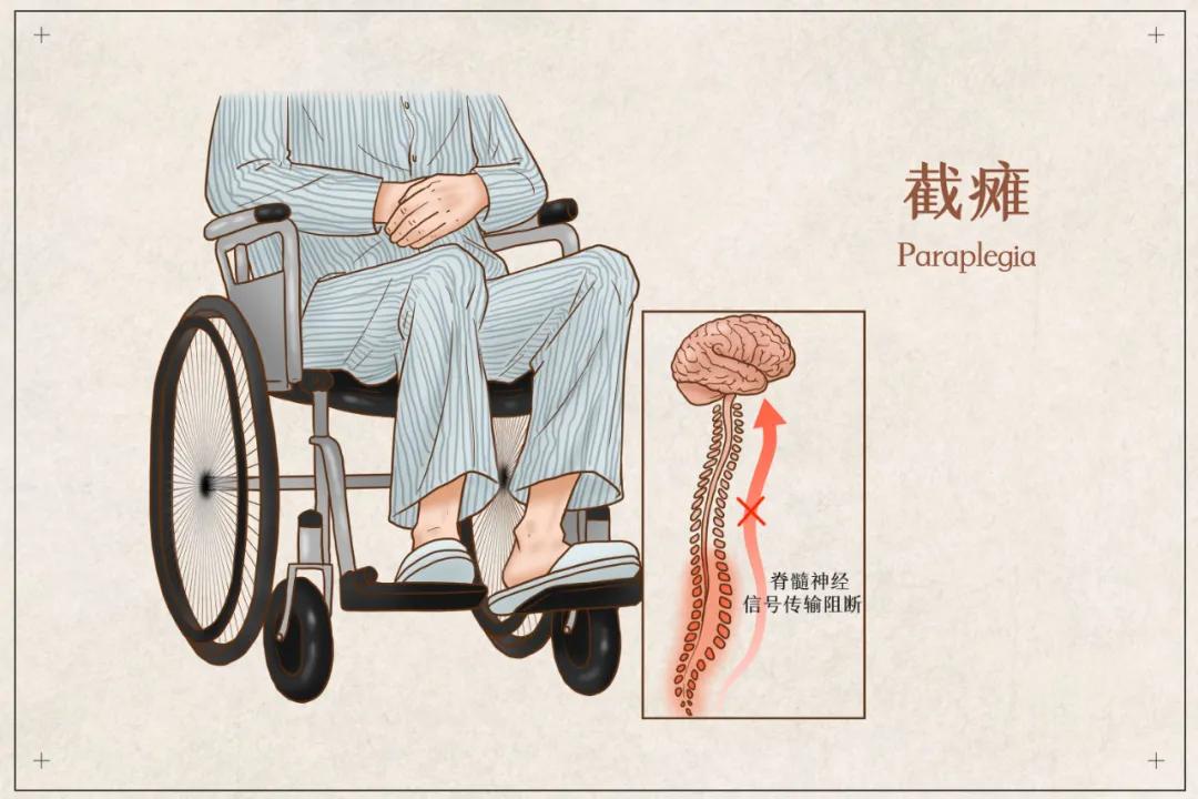 小针刀治疗腰椎颈椎效果好吗,颈型颈椎病小针刀治疗多久有效果
