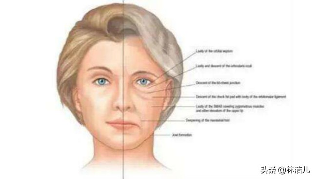 36岁的张钧甯“冻龄”人设不保？眼纹遮不住，周迅也有这个问题？