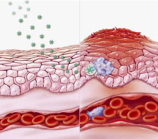 最有效祛痘疤方法,祛痘疤最有效的方法学生