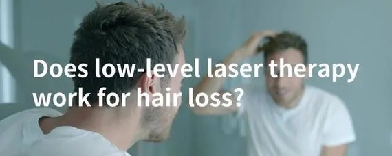 有了这个神器,英国人的脱发有救了?