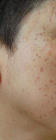 还我一张脸,还我一张脸完整版