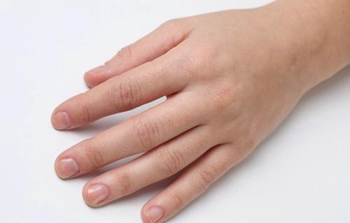 运动完双手发胀,运动完手肿胀是什么原因