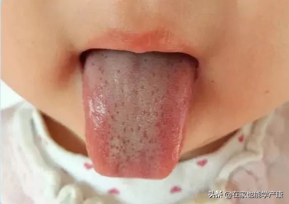 宝宝鹅口疮反复很烦人？试试小儿推拿手法，太有用了！