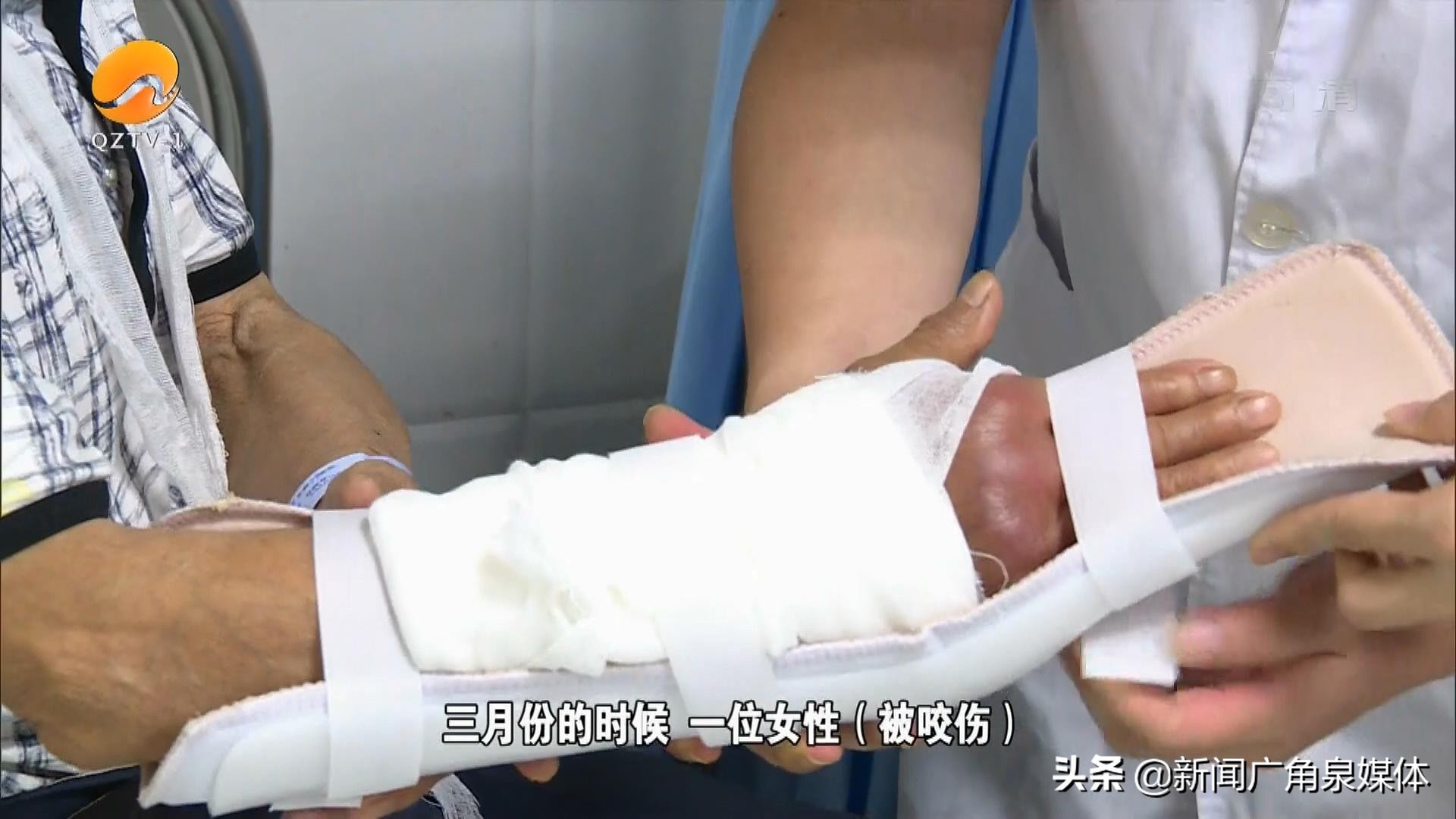 狗狗被大狗咬男子用棍子救命,宠物狗突然攻击小主人