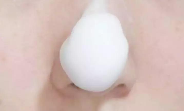 吸黑头神器去粉刺角质收缩毛孔,皮肤清洁收缩毛孔黑头角质