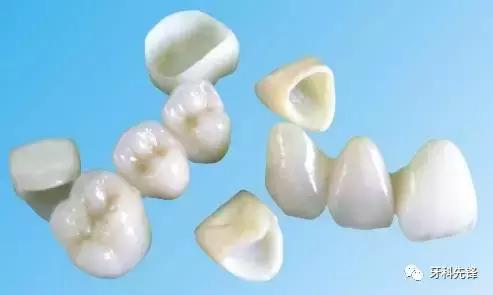 烤瓷牙和全瓷牙的优缺点是什么,钴铬合金烤瓷牙和全瓷牙优缺点