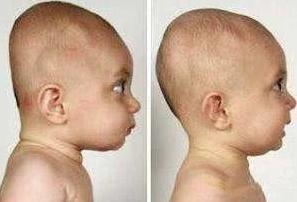 宝宝睡觉滚来滚去,枕头的存在重要吗?孩子多大才能用枕头?