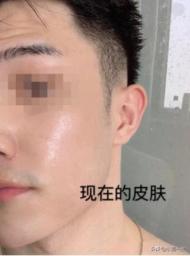 男士护肤哪一个好用又简单,男的用的最简单的护肤单品