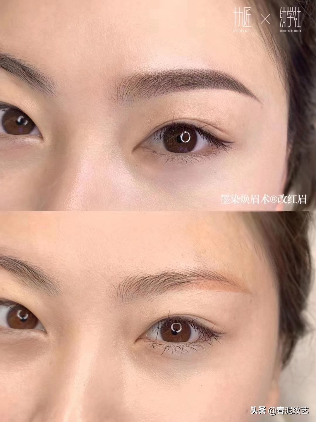 眉毛发红怎样纹眉补救,纹眉后眉毛发红怎么处理