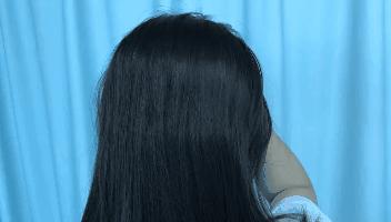 太秃头了怎么办,如何解决头顶秃