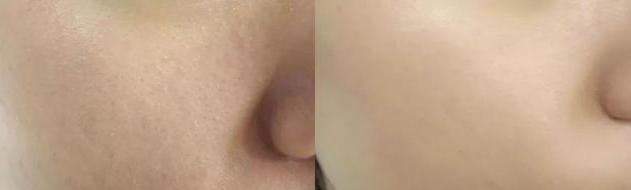 最好用的大牌定妆粉推荐,热门平价定妆粉