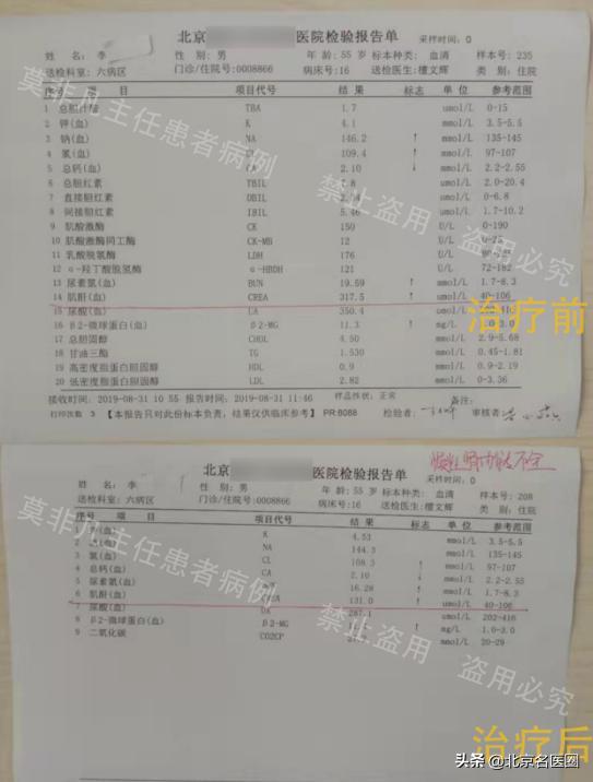 肾功能不全用中药降肌酐,肾功能不全如何控制肌酐蛋白尿