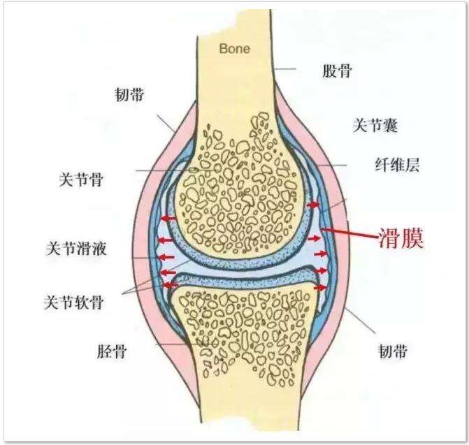 滑膜炎导致腿伸不直怎么治疗,腿伸不直也蹲不下去是什么原因