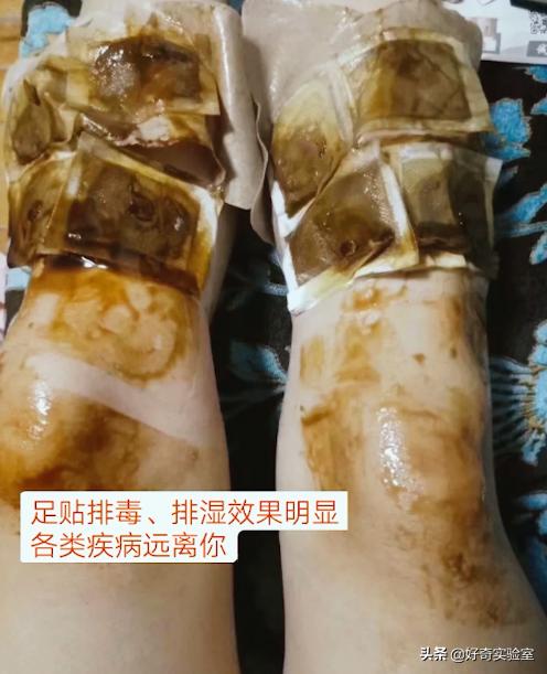 足贴祛湿气排毒怎么是黑的,足贴祛湿气排毒是真的吗