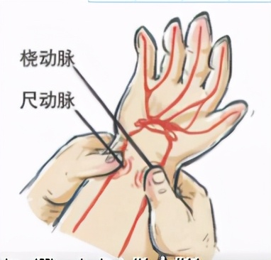 家人用皮筋包扎伤口结果导致截肢,截肢患者弹力绷带包扎法
