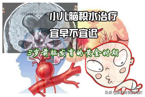 小儿脑积水能治愈吗,小儿脑积水治好了一般能活多久