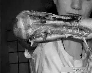 *毒冰**疮、*古麻**痘，拿什么来拯救这张脸？