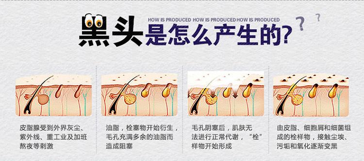 黑头怎么去除最有效最安全,黑头怎么去除最彻底