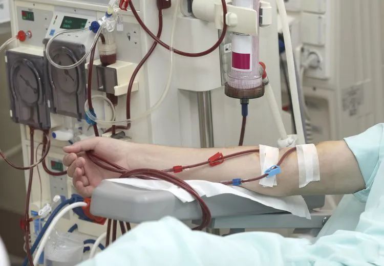 透析后的透路管理,透析需要做好哪些个人管理