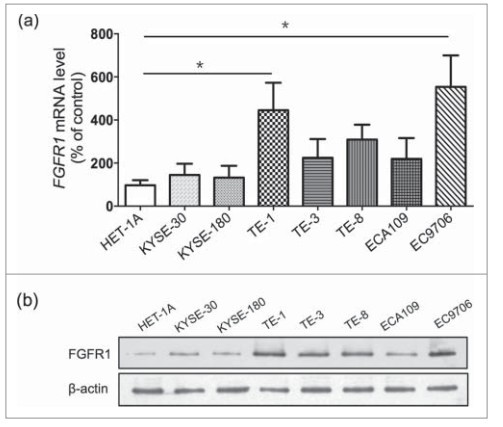 华西食管鳞状细胞癌专家,食道中分化鳞状细胞癌预后