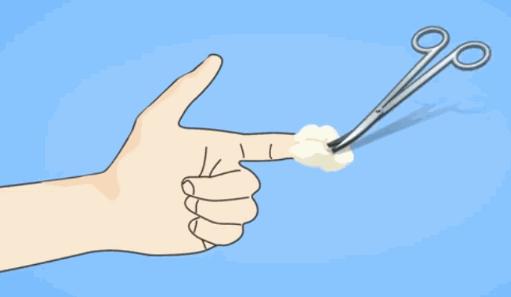 梅毒感染人数逐年递增，早期症状不明显，如何知道自己已中招？