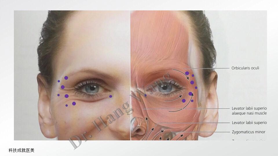 美帕涂抹肉毒素抗皱系列，用了后悔没有早点入手！