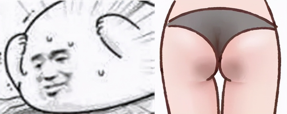 屁屁不红疼是怎么回事,屁屁凹凸不平如何改善