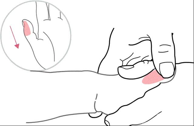 宝宝反复湿疹腹泻什么原因,宝宝湿疹大便臭怎么调理