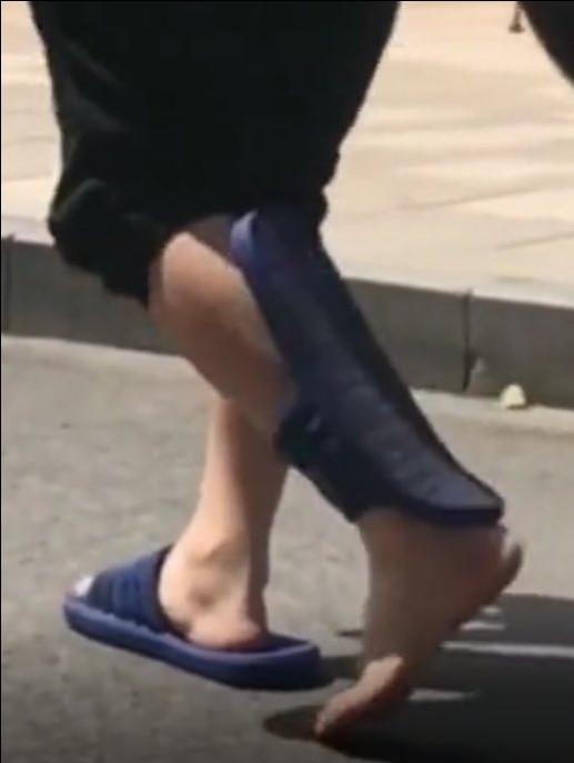 今日萌图,仓鼠身上长了疑似肿瘤的东西