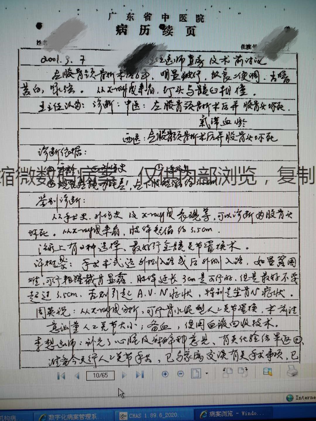90岁老人髋关节置换术死亡率多高,90岁老人微创髋关节置换技术