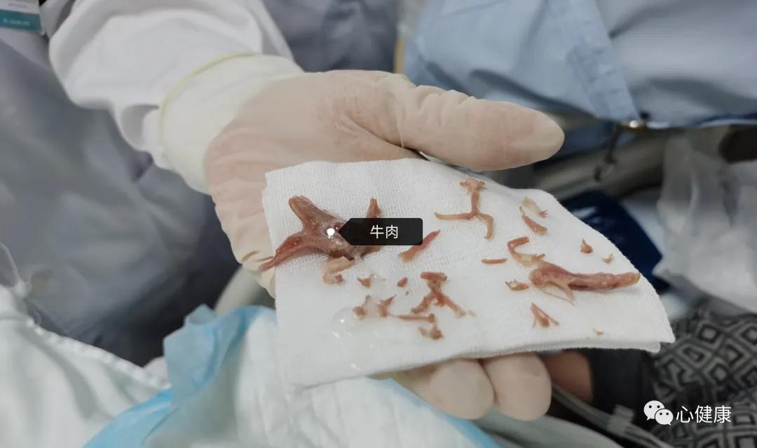 一块牛肉引发的事,一块肉引发的血案电影解说